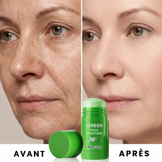 Masque miracle anti-points noirs