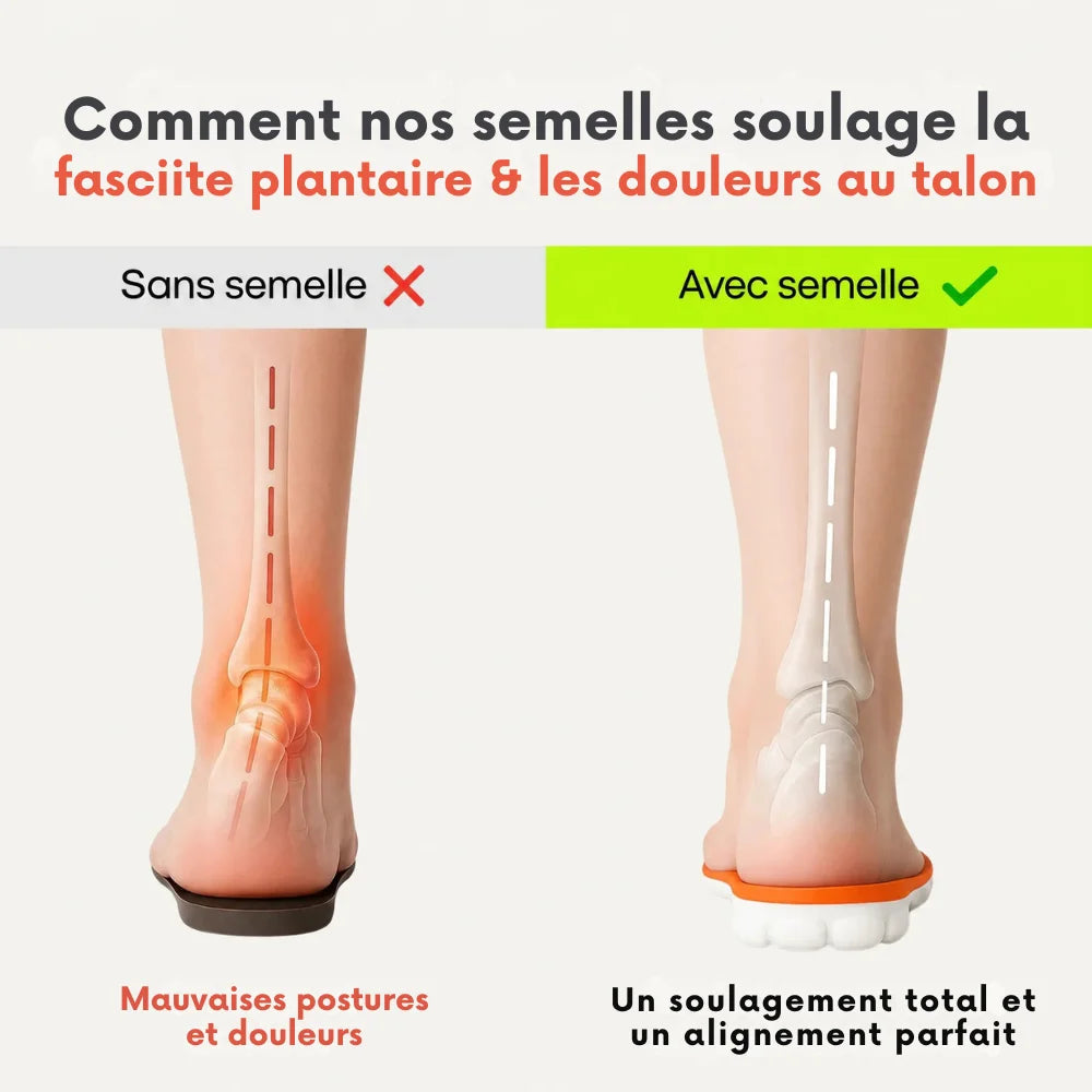 Semelles Thérapeutiques Anti-Douleur fasciite plantaire