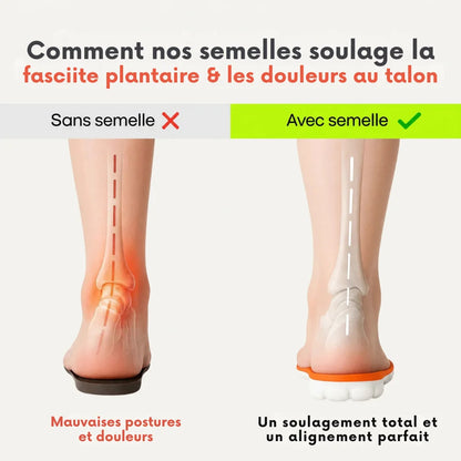 Semelles Thérapeutiques Anti-Douleur fasciite plantaire