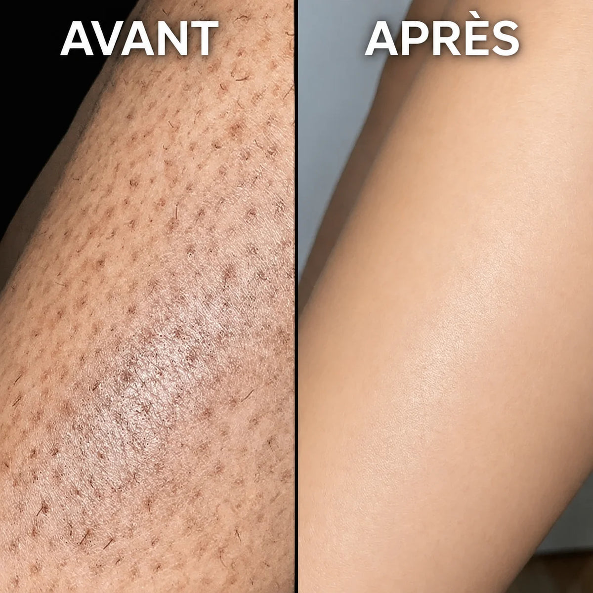 Velys Sérum Anti-Repousse Végétal