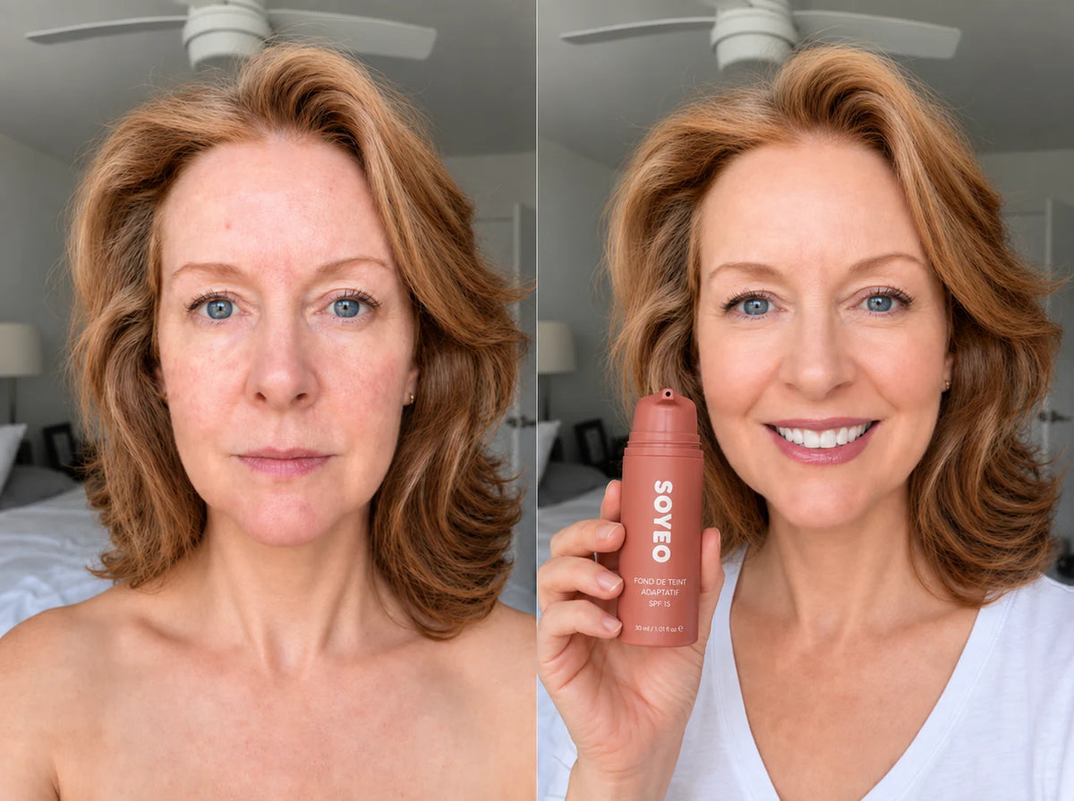 Carole N. avant et après